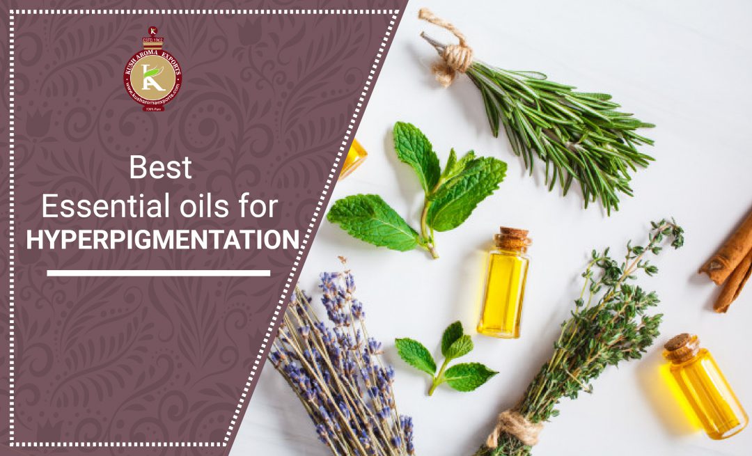 essential oils for hyperpigmentation