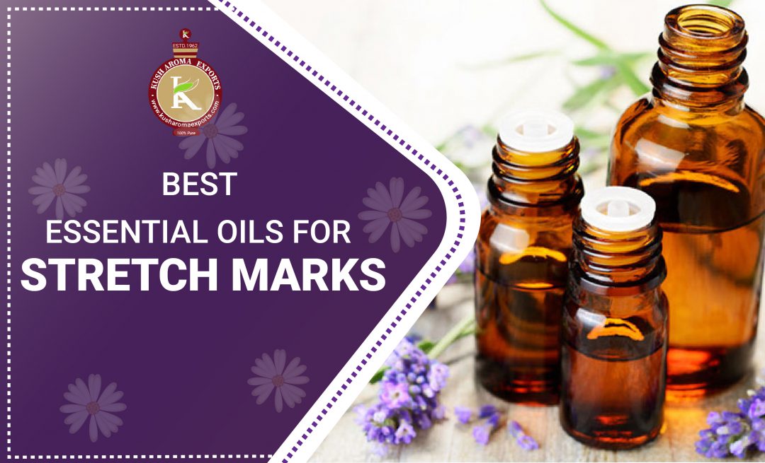 essential oils for stretch marks