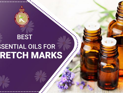 essential oils for stretch marks