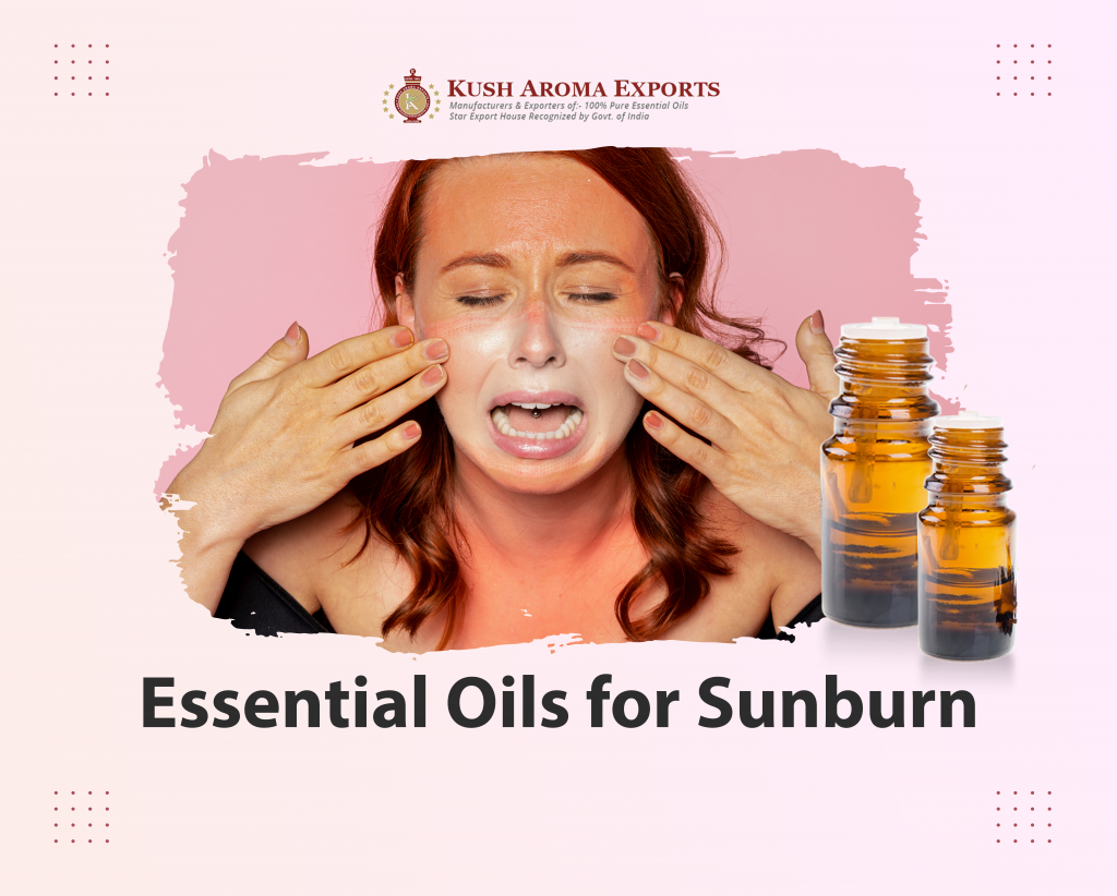 Essential Oils for Sunburn