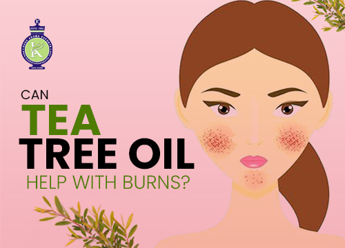 Can Tea Tree oil help with Burns? 